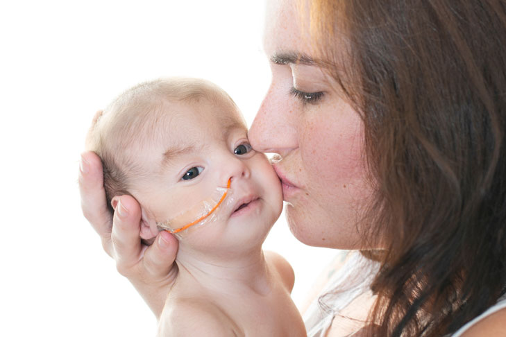 Best Practice for Neonatal Nasogastric (NG) Tube Feeding